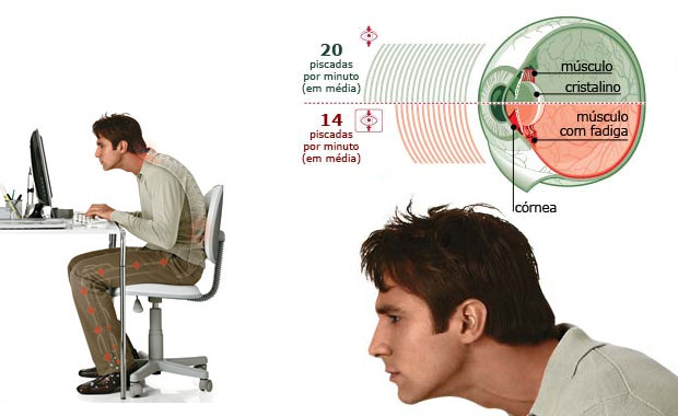 Infográfico