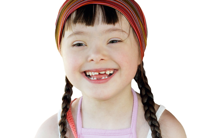 Síndrome de Down: vida longa e saudável