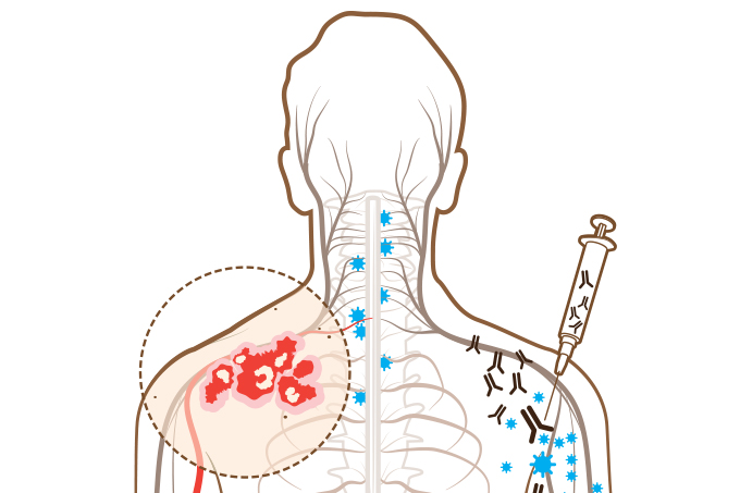 herpes-zoster-prevencao-tratamento-sintomas