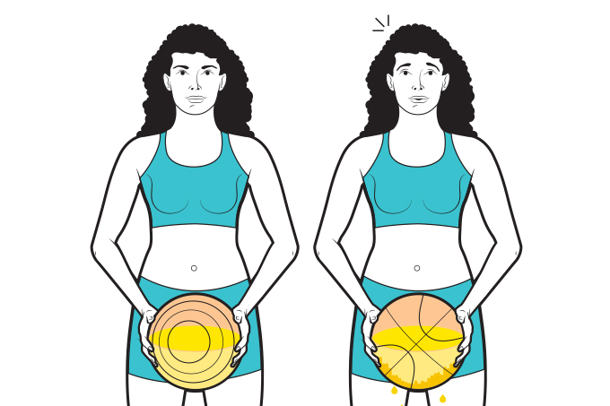 atividade-fisica-incontinência-urinária