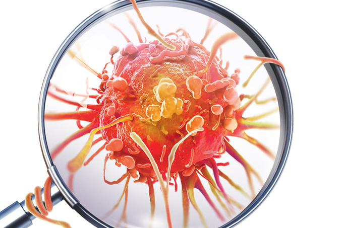 outra-opcao-para-tratar-cancer-pulmao-bexiga