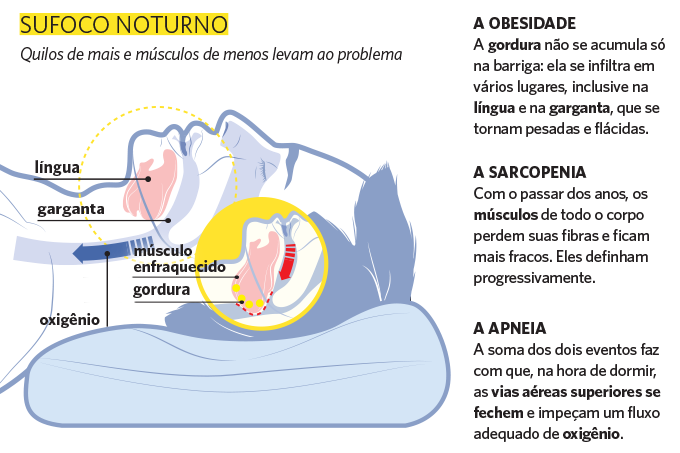 Sufoco noturno.