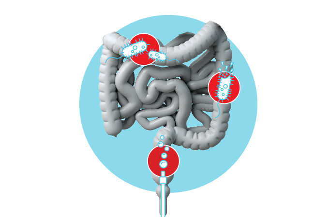 infecção no intestino