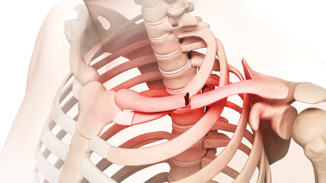 como tratar osteoporose