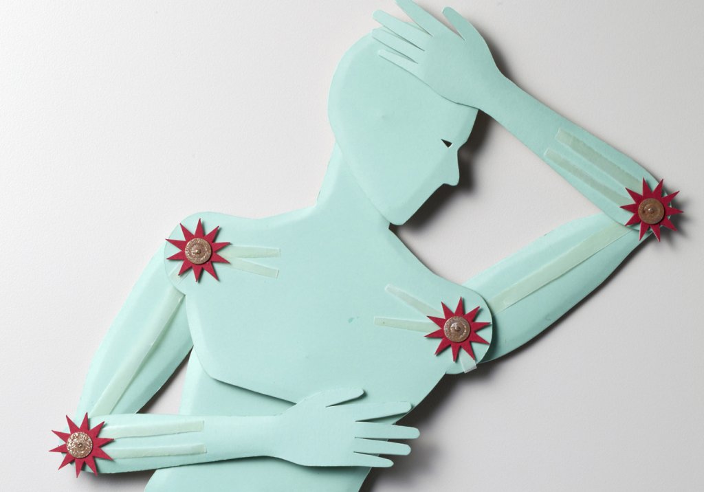 Reumatologistas ainda são poucos e raros no Brasil