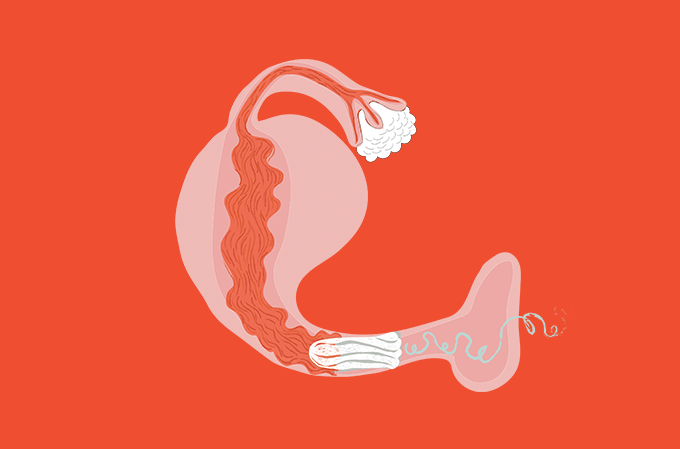 Desenho de absorvente no canal vaginal