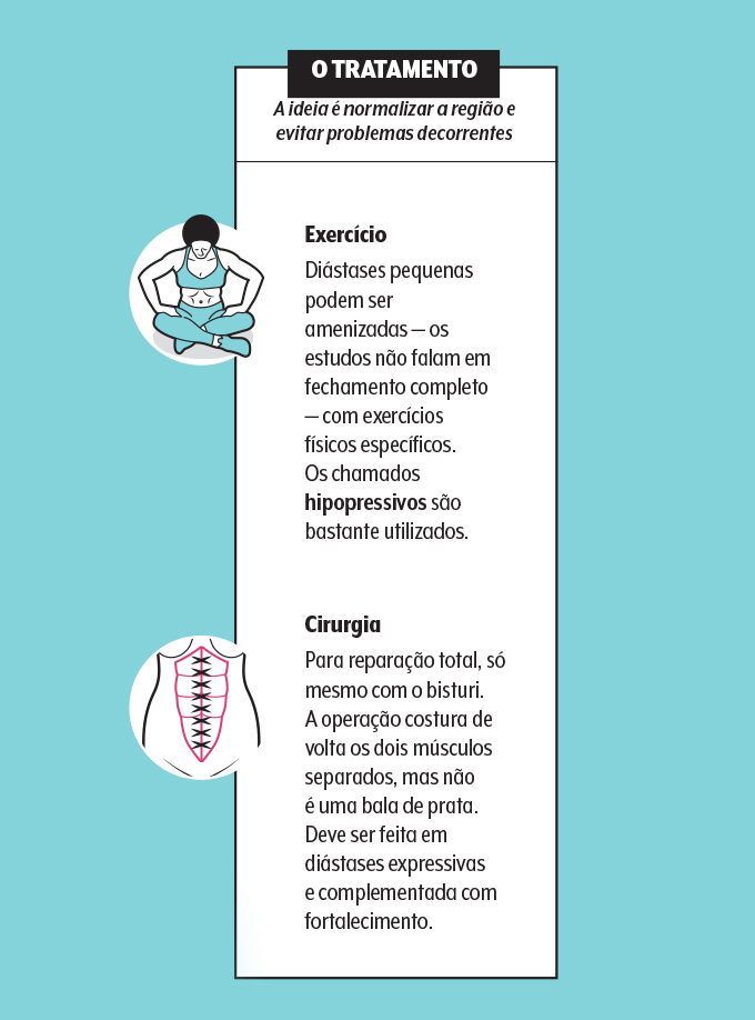 tratamento-da-diastase