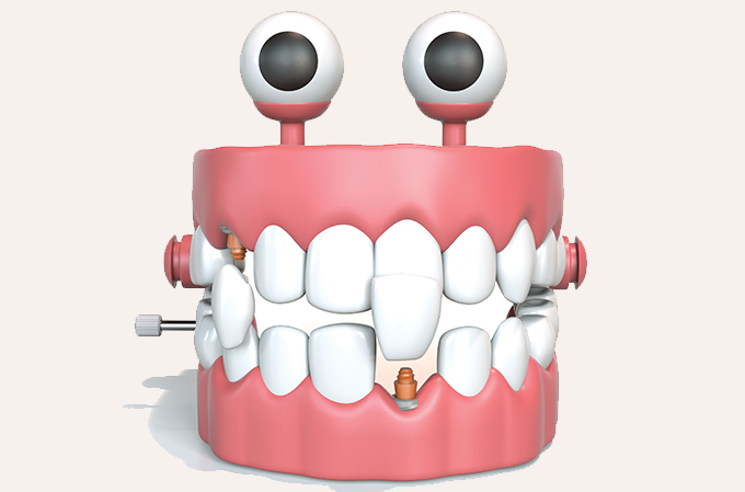 imagem de boca em 3D com um implante dentário