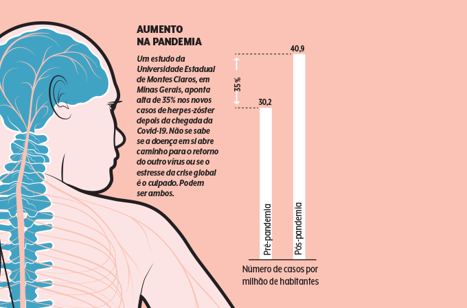 aumento do herpes zoster na pandemia aumento de casos de herpes-zóster na pandemia