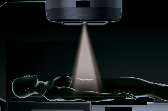 Radioterapia: tratamento está mais eficaz e preciso
