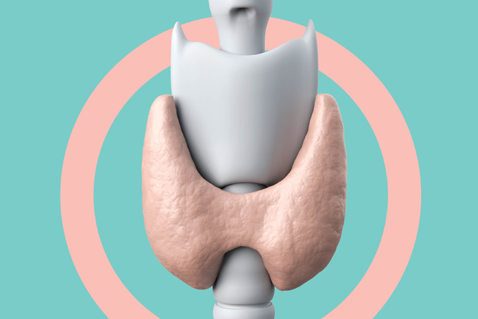 cirurgia de tireoide