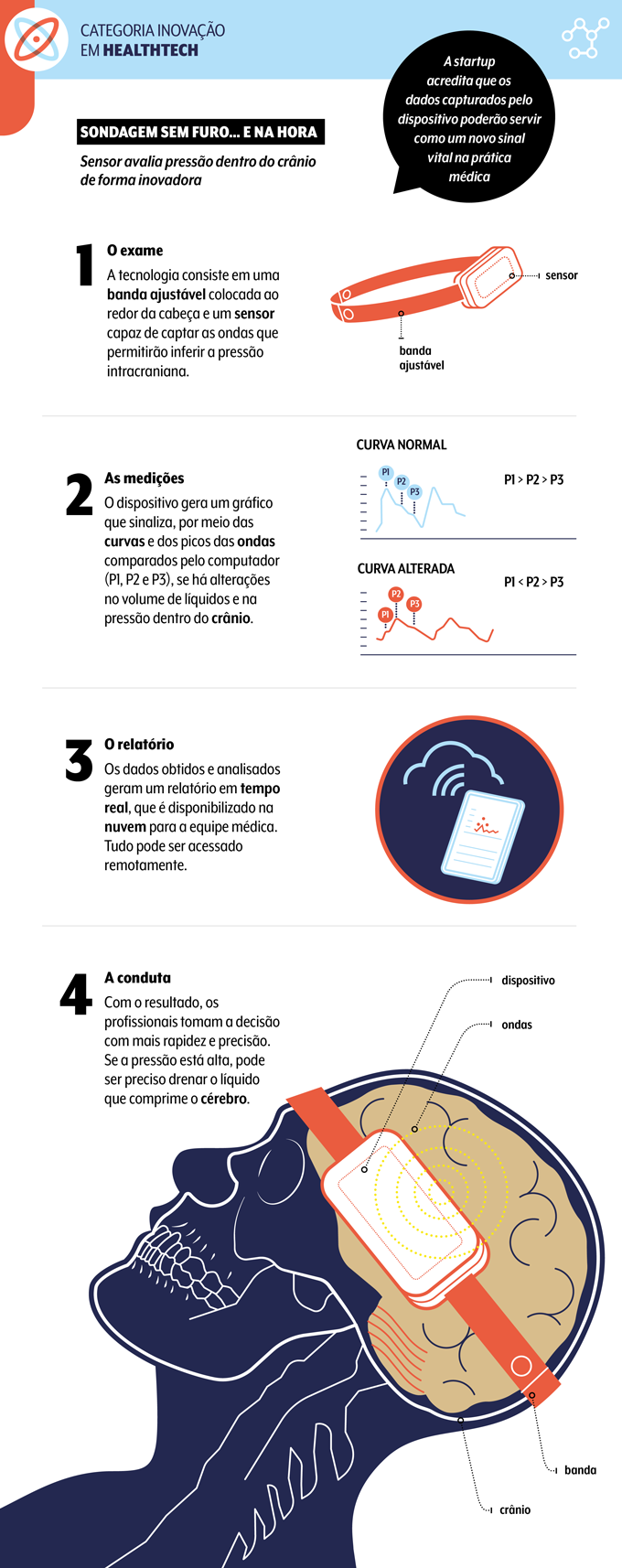 infográfico sobre dispositivo portátil e não invasivo que mede pressão intracraniana da brainfourcare