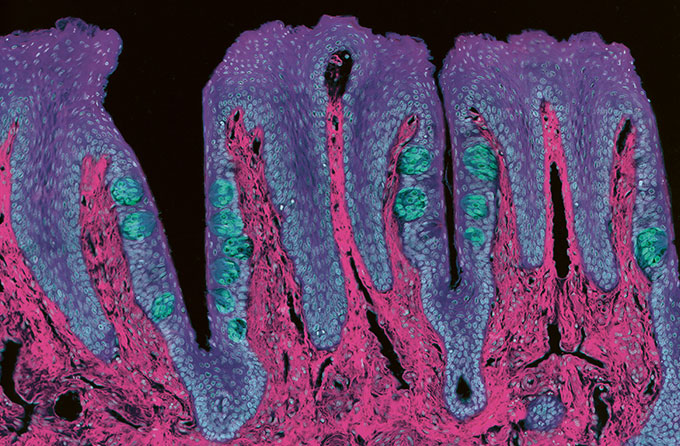 foto microscópica da papila gustativa