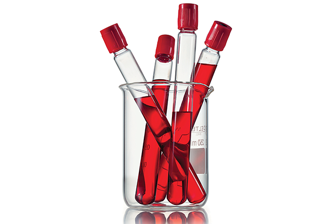 Primeiro exame de sangue a avaliar risco de Alzheimer chega ao Brasil