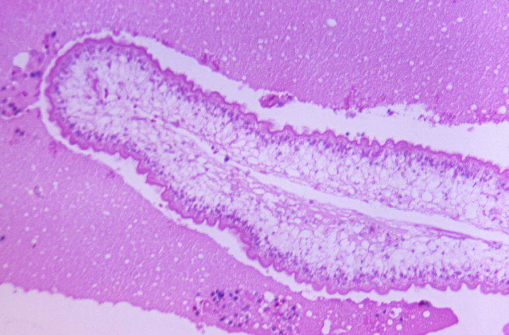 Albendazol: para que serve, como tomar e quais os efeitos colaterais?