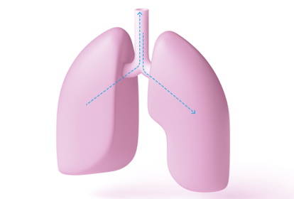 ventilação mecânica