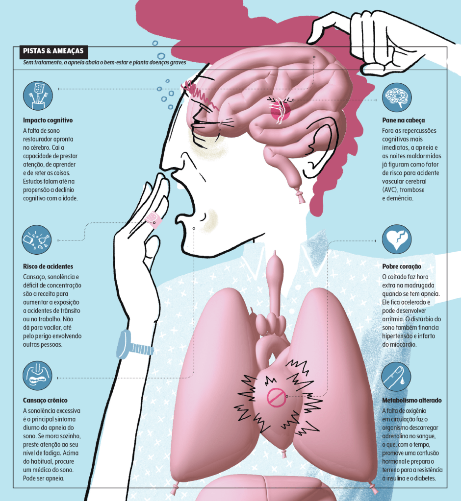 Apneia do sono: sinais