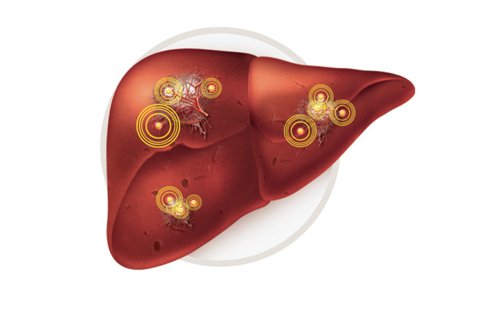 hepatite-viral