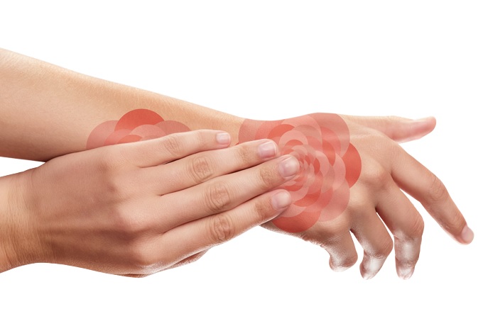 Artrite psoriásica: uma em cada três pessoas com psoríase tem a doença