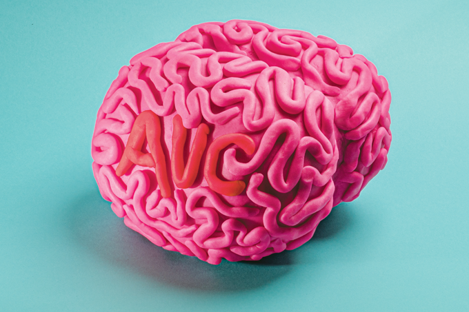 Sobreviver ao AVC é só o começo: saiba a importância da reabilitação