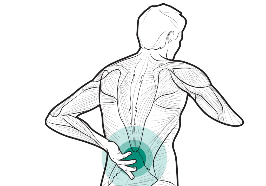 Recomendações da OMS para o tratamento não cirúrgico da dor lombar crônica