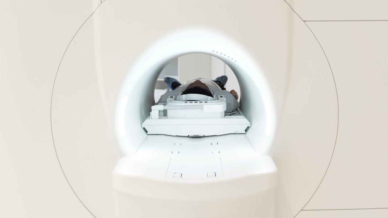 pet-scan-o-que-e-quando-exame-indicado-tomografia-ressonancia