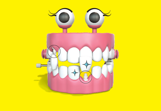 implante-dentario-coroa-protese