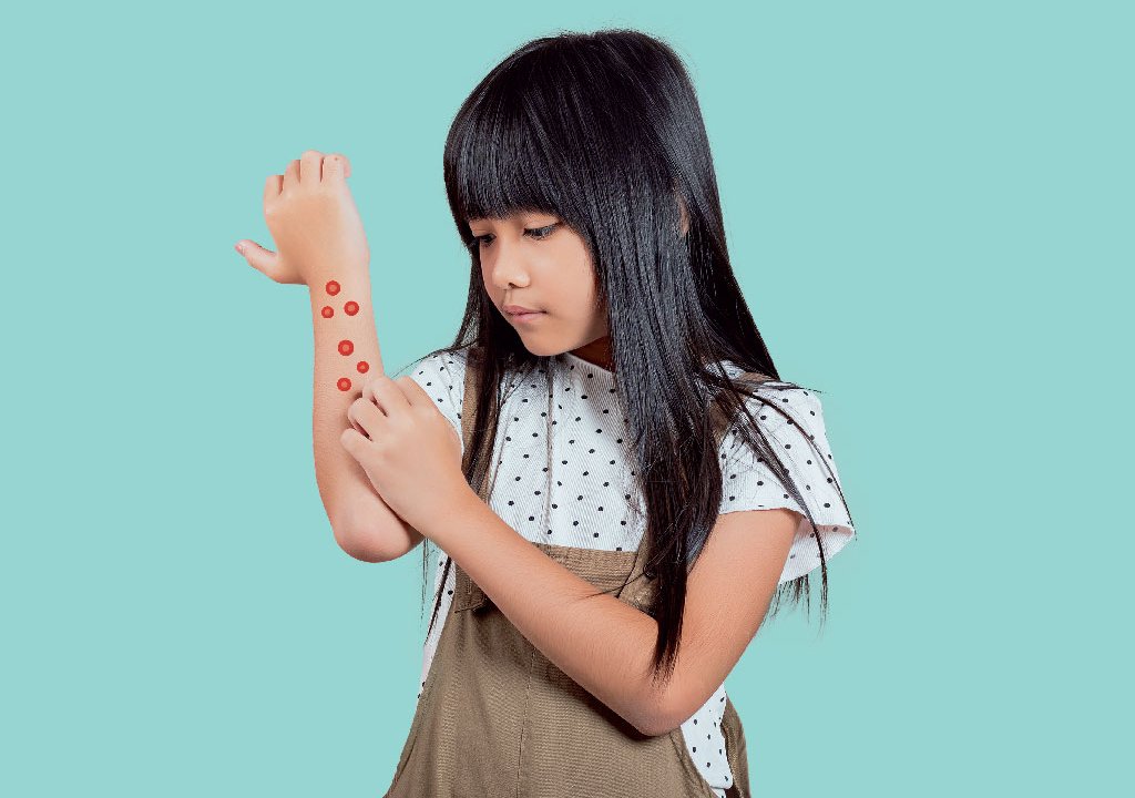 molusco-contagioso