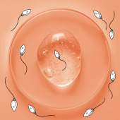 contraceptivo-masculino