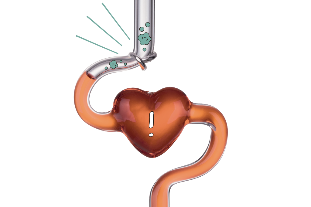 Exame faz varredura das placas de gordura nas artérias