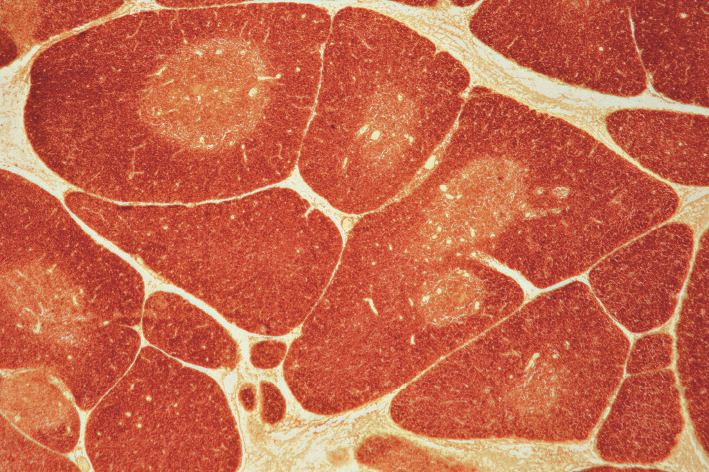 Zoom: quartel-general